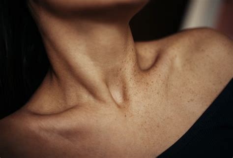 Clavicle Collarbone Pain Causes Home Remedies And Prevention Tips