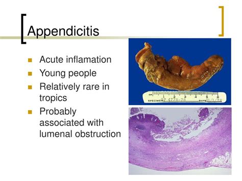 Ppt The Appendix Powerpoint Presentation Free Download Id1151158