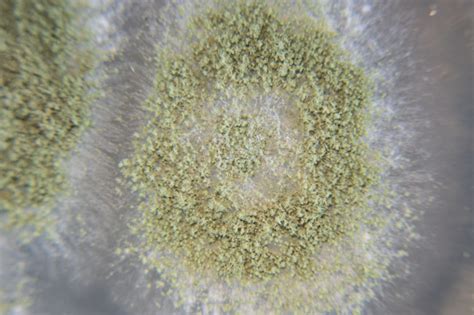 Close Up Of Aspergillus Oryzae Is A Filamentous Fungus Or Mold That Is