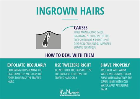 Mr Maroosh On How To Shave Without Getting Ingrown Hairs In 3 Simple