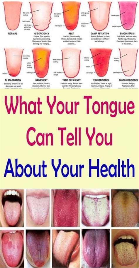 what your tongue can tell you about your health healthy tongue tongue health health tips