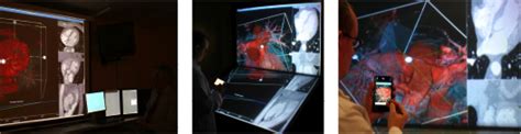 Healthcare Technology | Improved Insight into Medical Imaging Through Remote Stereo ...