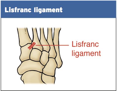 Lisfranc Ligament Anatomy