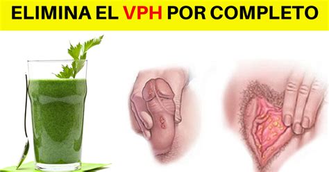 El Vph Como Curarlo Naturalmente Comprobado Mejor Salud Natural