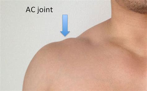 The Complete Guide To Ac Joint Separation Kinetic Labs Toronto