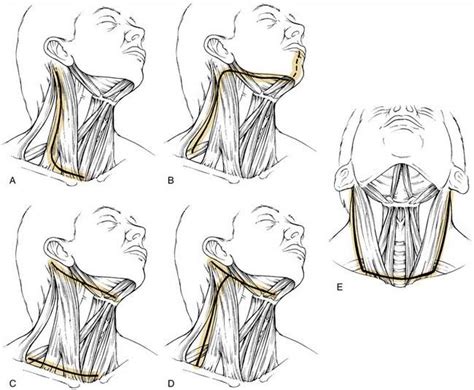 An Image Of How To Draw The Head And Neck
