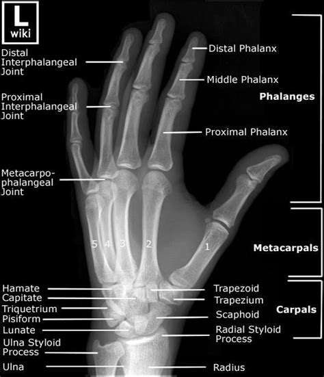 Radiographic Anatomy Hand Oblique Unidad Especializada En Ortopedia