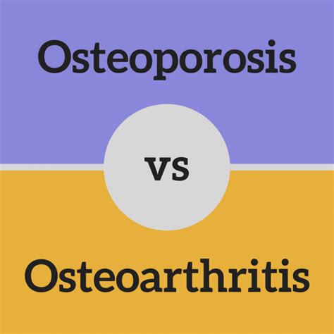 Osteoporosis Vs Osteoarthritis