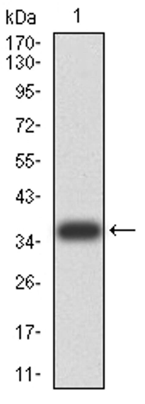Foxm1 Monoclonal Antibody 6f11a8 Ma5 38524