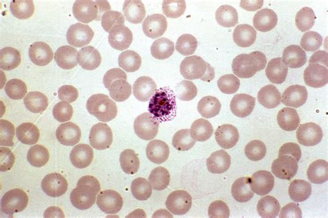 Free Picture Photomicrograph Shows Red Blood Cell Infection