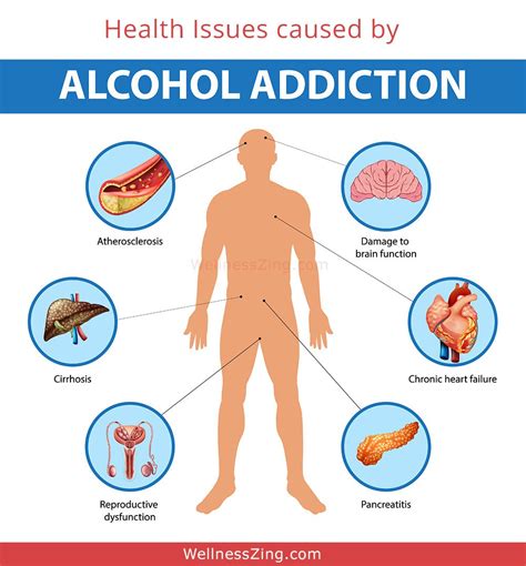 What Is Alcohol Addiction Side Effects And Treatment