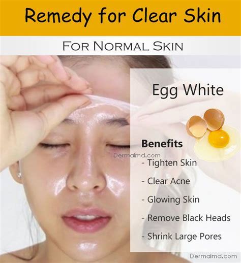 Pin On How To Make Skin Lighter