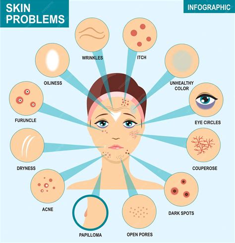 Premium Vector Skin Problems Infographics Woman And Set Of The Most