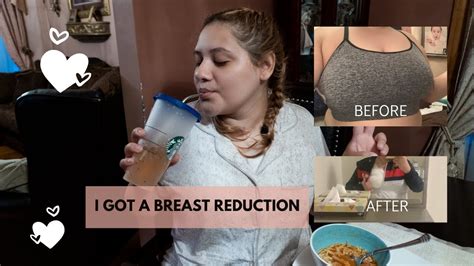 Breast Reduction Surgery Vlog Surgery Day Youtube