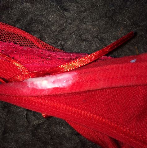 tmi but what is this on my panties i know it s discharge but does it look like a yeast