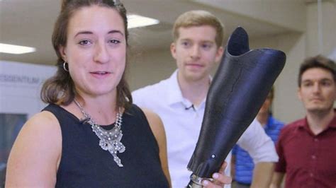Bbc Reporter And Amputee Tries Out 3d Printed Legs Bbc News