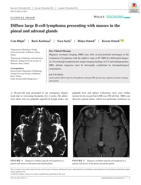 Pdf Diffuse Large B‐cell Lymphoma Presenting With Masses In The