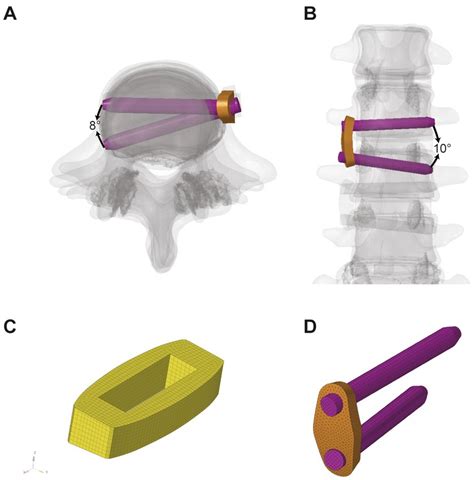 Biomechanical Study Of Two Level Oblique Lumbar Interbody Fusion With