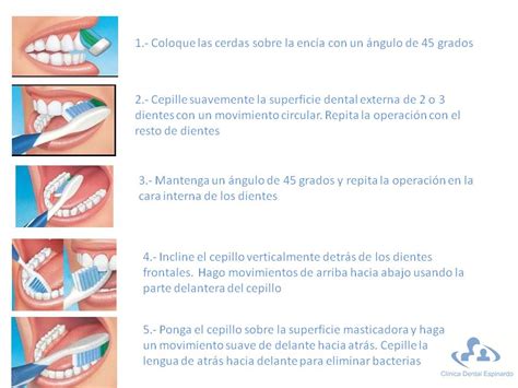 Cl Nica Dental Espinardo Nuestros Expertos Responden La T Cnica De Cepillado