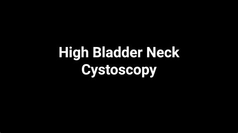 High Bladder Neck Cystoscopy Youtube