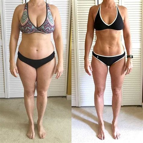 Thighs Before And After Weight Loss