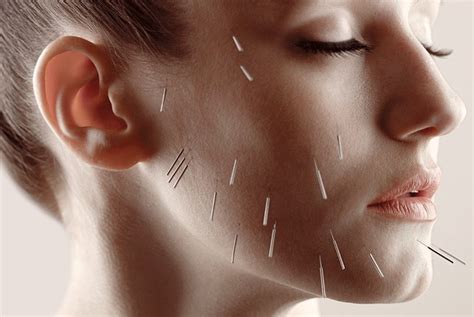 Facial Acupuncture And Cosmetic Acupuncture Cape Fear Community