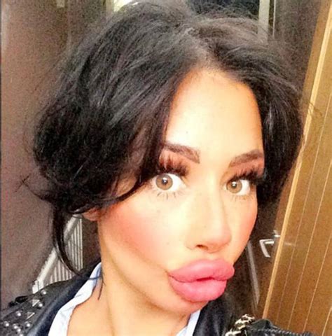 This Woman Wants To Take Her Huge Lips And Make Them Even Bigger Others