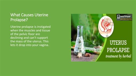Ppt Uterine Prolapse Whats Everything You Need To Know Powerpoint