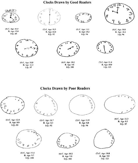 The montreal cognitive assessment (moca) is a widely used screening assessment for detecting cognitive impairment. Examples of clocks drawn by children from the no dyslexia ...
