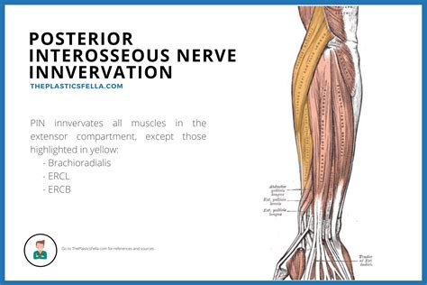 Posterior Interosseous Nerve Syndromepalsy Illustrations Videos