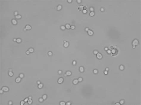Yeast Cell Under Light Microscope Micropedia