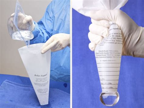 Colocação de prótese de silicone com Funil de Keller - Cirurgia.net