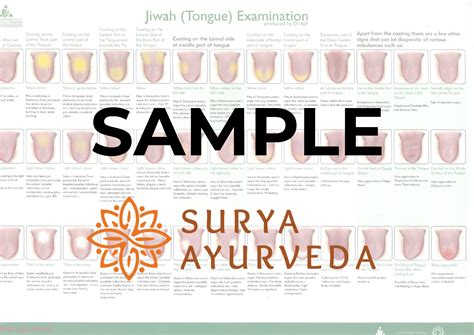 Tongue Diagnosis Chart New Style Surya Ayurveda