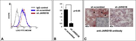 A Temporarily Distinct Subpopulation Of Slow Cycling Melanoma Cells Is