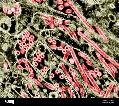 Electron Microscope Influenza Virus Flu Virus Micropedia