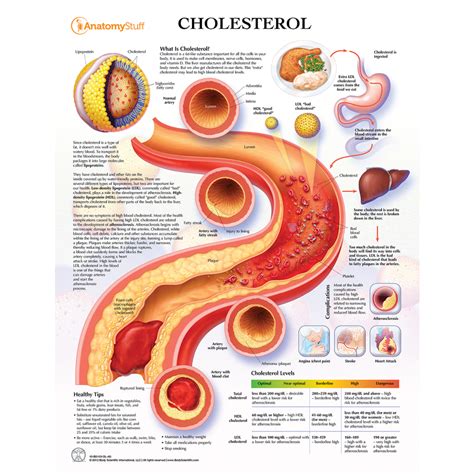 How does cholesterol cause heart disease? Cholesterol Understanding LDL & HDL Chart Poster Laminated ...