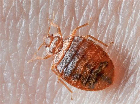 How To Tell If You Have Bed Bugs The Most Unmistakeable Signs Here