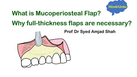 mucoperiosteal flap in oral surgery oral and maxillofacial surgery syed amjad shah youtube