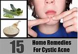 Pictures of Cystic Acne Home Remedies