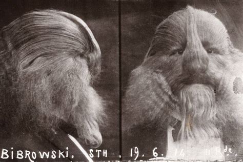 Stephan Bibrowski A Sideshow Performer Known As The Lion Faced Man