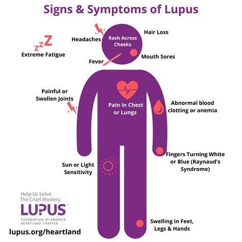 Lupus Checklist Printable
