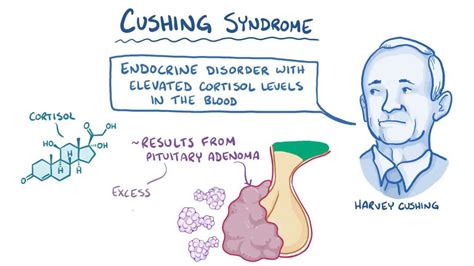 Cushings Syndrome Pathophysiology