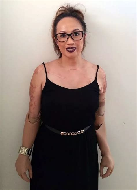 meet the human mannequin brave woman who lost limbs to meningitis is now 40 per cent plastic
