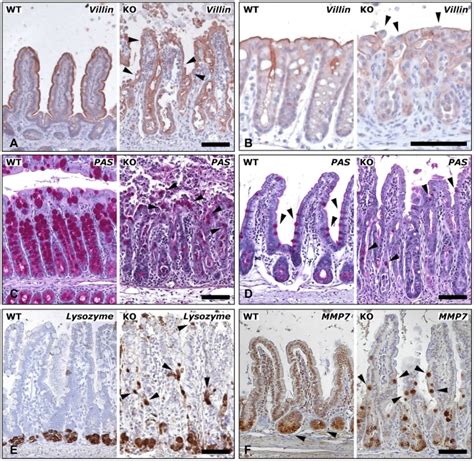 A And B Staining Of Absorptive Enterocytes For Villin Reduced