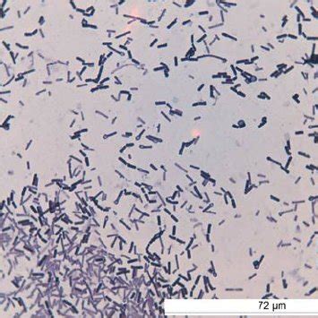 A Spores And Bacteria Of Clostridium Tetani With A Typical Drum Stick