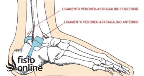 Ligamento lateral externo del tobillo Qué es origen inserción