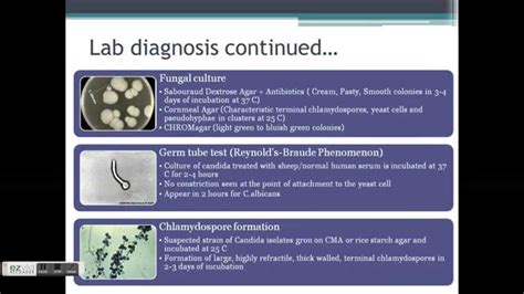 Candidiasis Types Symptoms Causes Diagnosis Treatment Vrogue Co