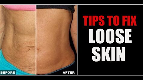 How To Tighten Up Loose Skin Sagging Skin Belly Arm Skin Info By