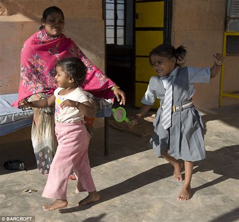 The Unbelievable Tale Of Lakshmi Tatma A Girl Born With Eight Limbs