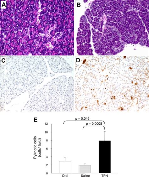 Pancreatic Atrophy Induces Acinar Cell Apoptosis And A Loss Of Zymogen